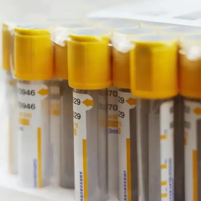 Tube de collecte de sang 3/5/10ml, Gel de séparation de récipient, Coagulant jetable sous vide, pression négative, Tube jaune de collecte de sang