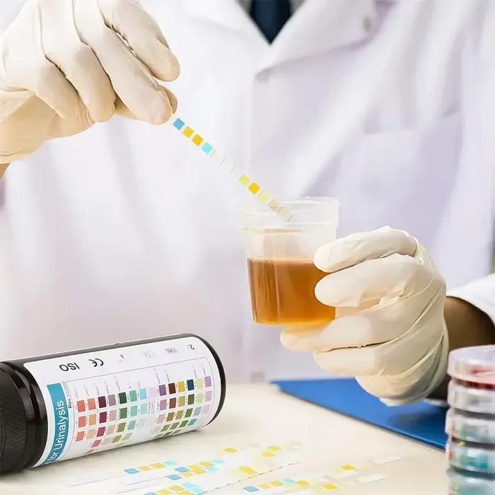 Bandelettes de test d'urine 14 en 1, analyse d'urine UTI pour galvanopien, bilirubin, cétone, nitrite, leucocytes, gravité spécifique, pH, acide ascorbique